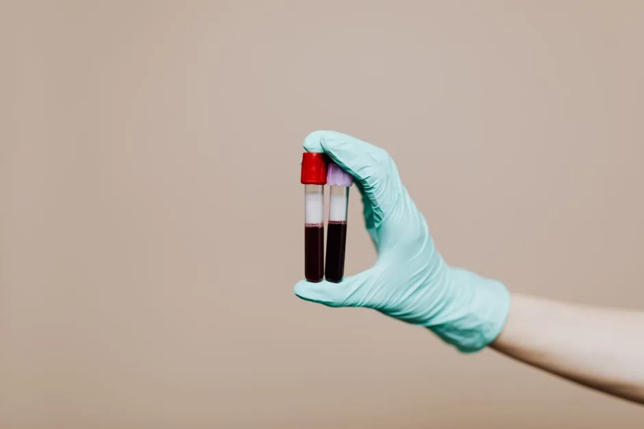 Anemia in End-Stage Liver Disease: What You Need to Know