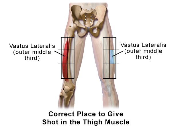 Can You Inject Tymlos in the Thigh? Essential Guide